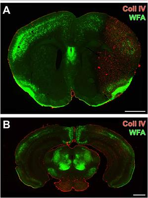 Damaged Neocortical Perineuronal Nets Due to Experimental Focal Cerebral Ischemia in Mice, Rats and Sheep